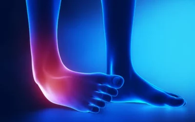 ANKLE SPRAIN GRADES AND TREATMENT